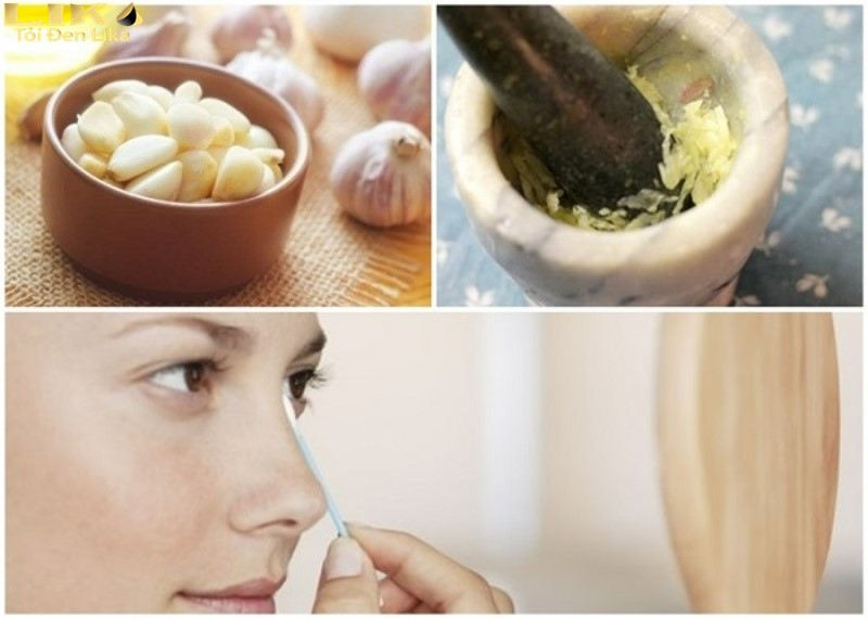 Bật mí 5 cách trị mụn bằng tỏi tại nhà an toàn, hiệu quả 4 Các cách trị mụn bằng tỏi chỉ nên áp dụng tối đa 3 lần/tuần