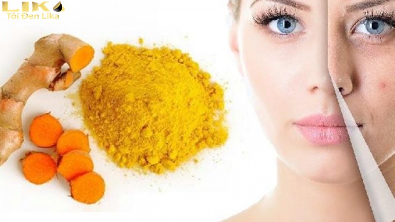 Bật mí 5 cách trị mụn bằng tỏi tại nhà an toàn, hiệu quả 7 Phương pháp trị mụn bằng tỏi tươi và bột nghệ